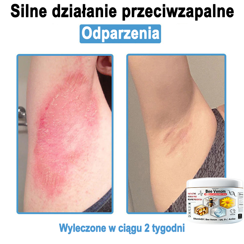 TOD𝐀HOF™🥑 Krem do wielosymptomowej pielęgnacji skóry z jadem pszczelim (Zalecane przez PZH)