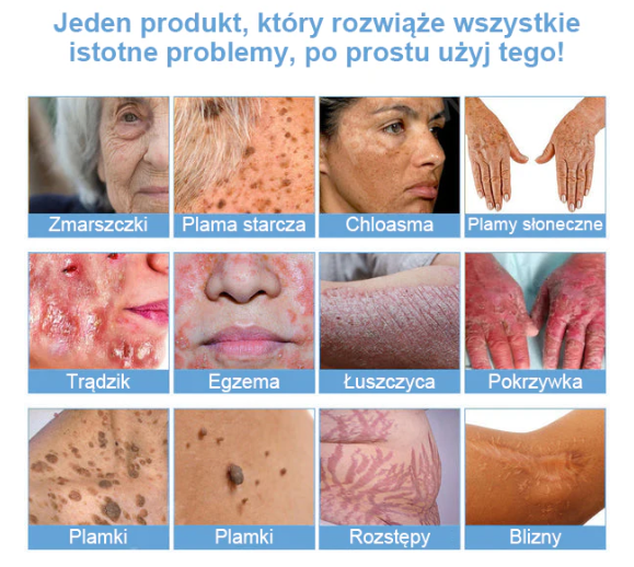 TOD𝐀HOF™🥑 Krem do wielosymptomowej pielęgnacji skóry z jadem pszczelim (Zalecane przez PZH)