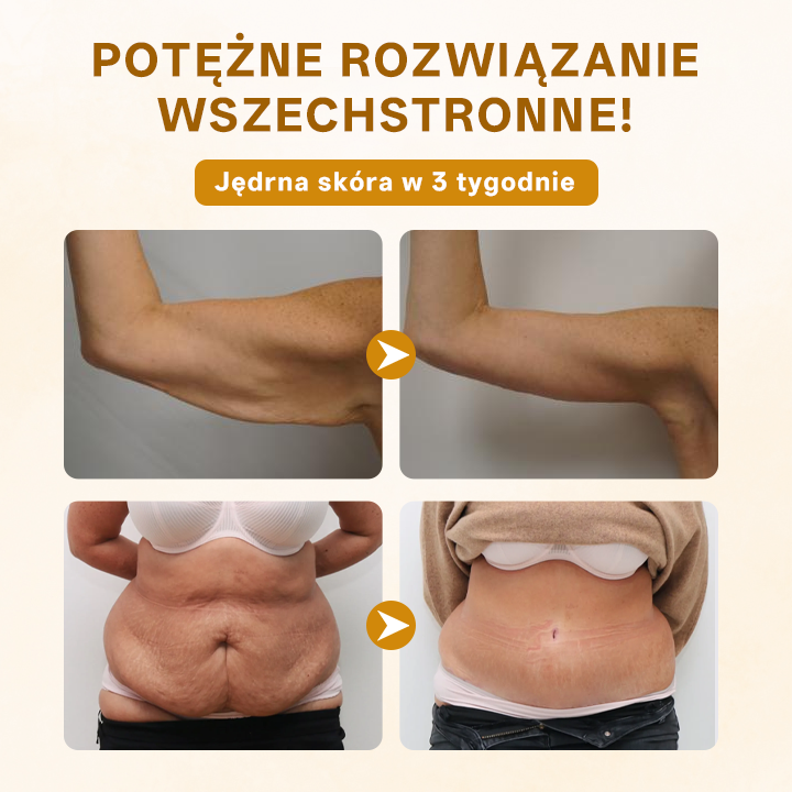 ✨ Timilk® ✨ Ekskluzywny 🌸 Krem Odmładzający z Jadem Pszczelim 🐝 | Luksusowa Pielęgnacja Anti-Aging 💎