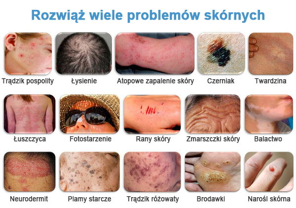 TOD𝐀HOF™🥑 Krem do wielosymptomowej pielęgnacji skóry z jadem pszczelim (Zalecane przez PZH)