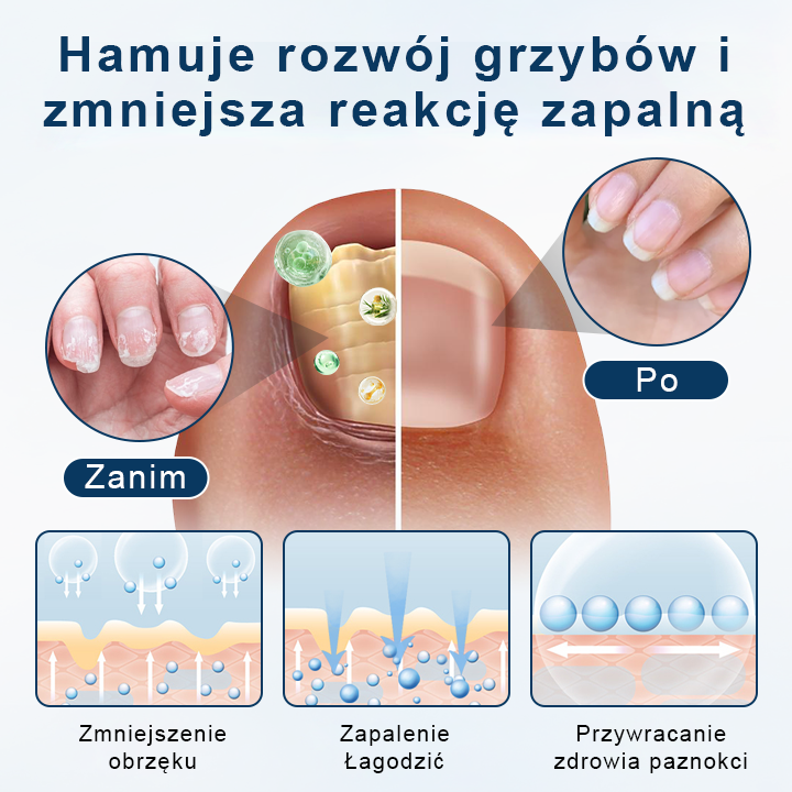 ✨ Timilk® ✨ – 🌿 Ziołowy Spray Przeciwgrzybiczy do Paznokci i Skóry 🦶