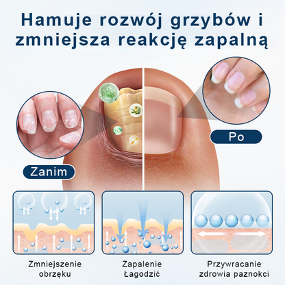 ✨ Timilk® ✨ – 🌿 Ziołowy Spray Przeciwgrzybiczy do Paznokci i Skóry 🦶
