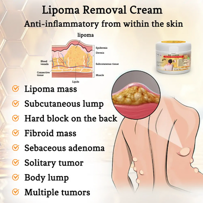 👨‍⚕🐝[👑Official Brand Store👑] Cvreoz™ Bee Venom Lipoma Removal Cream