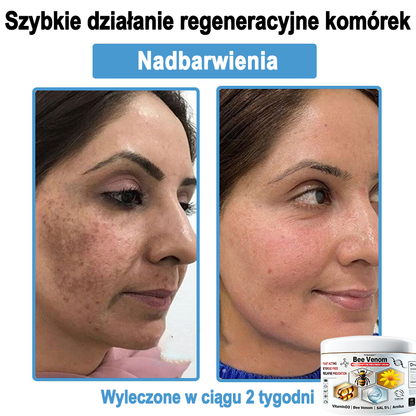 TOD𝐀HOF™🥑 Krem do wielosymptomowej pielęgnacji skóry z jadem pszczelim (Zalecane przez PZH)