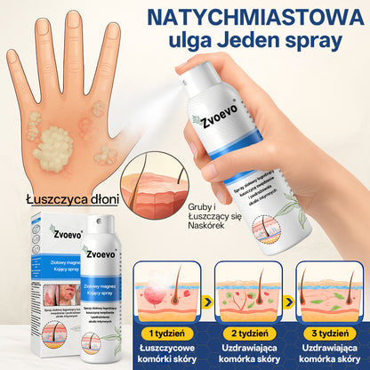 ✅ Oficjalny Sklep: Zvoevo® Magnezowy Ziołowy Spray na Łuszczycę ⚕️ Certyfikowany przez FDA (Łagodzi łuszczycę i egzemę, poprawia infekcje bakteryjne w okolicach intymnych, leczy trądzik i brodawki, łagodzi ból stawów i ból neuropatyczny)