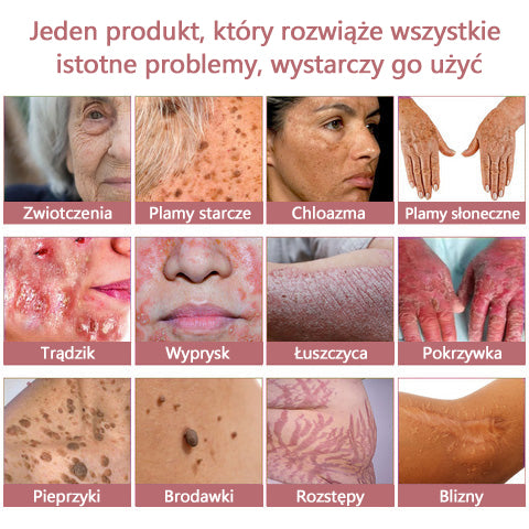 Krem kolagenowy w żelu Awzlove™ z koenzymem Q10 jest produktem zatwierdzonym przez Polskie Towarzystwo Dermatologiczne (PTD) i spełnia rygorystyczne normy Narodowego Instytutu Zdrowia Publicznego (PZH).