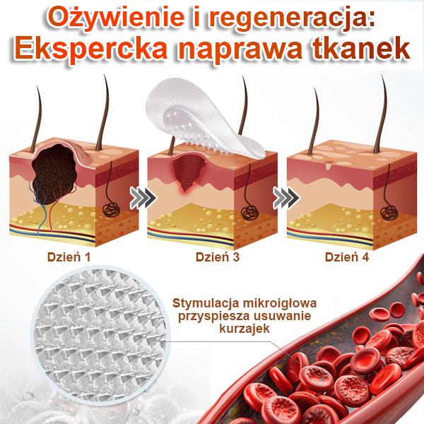 KUBOZN® – 🌿 Mikroigłowy Botaniczny Plaster 🌿 Skuteczne Usuwanie Narośli Skórnych | 💎 Naturalna Formuła