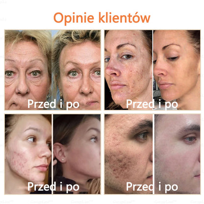 [Oficjalny Sklep Marki]🐴 2025 Nowy Krem Terapeutyczny z Olejem Końskim (👨‍⚕𝐑𝐄𝐊𝐎𝐌𝐄𝐍𝐃𝐀𝐂𝐉𝐀 CDA)