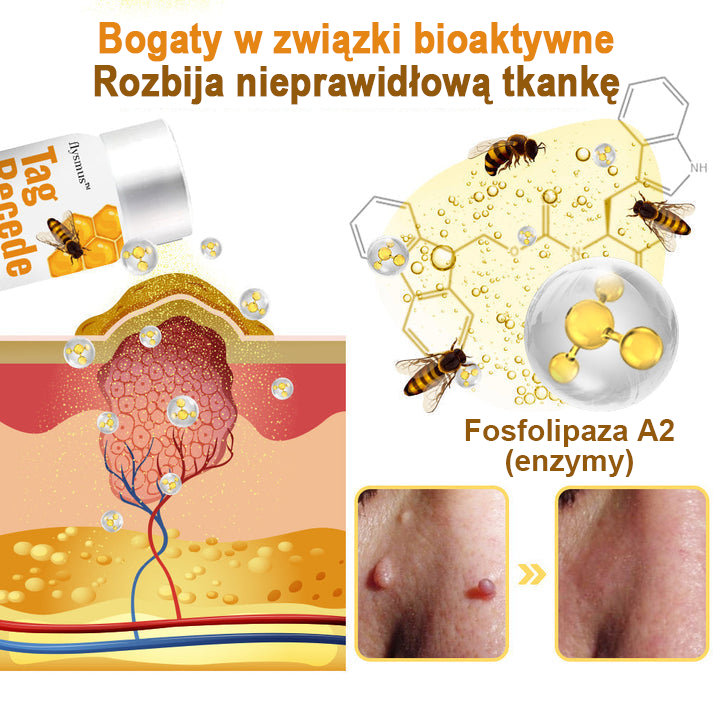 🐝flysmus™ Sprej z jadem pszczelim do usuwania brodawek i znamion skórnych 🐝