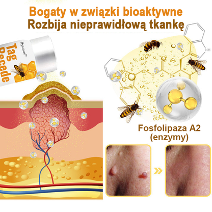 🐝flysmus™ Sprej z jadem pszczelim do usuwania brodawek i znamion skórnych 🐝