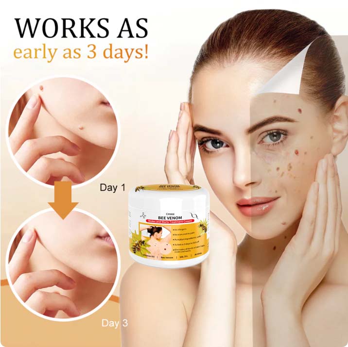 🍀🐝[👑Official Brand Store👑] Cvreoz™ Bee Venom Mole and Wart Treatment Cream(👨‍⚕AAD RECOMMENDS)