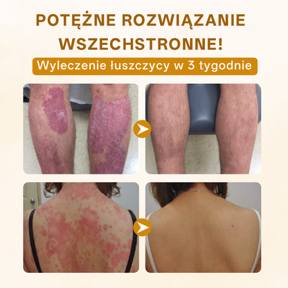 ✨ Timilk® ✨ Ekskluzywny 🌸 Krem Odmładzający z Jadem Pszczelim 🐝 | Luksusowa Pielęgnacja Anti-Aging 💎