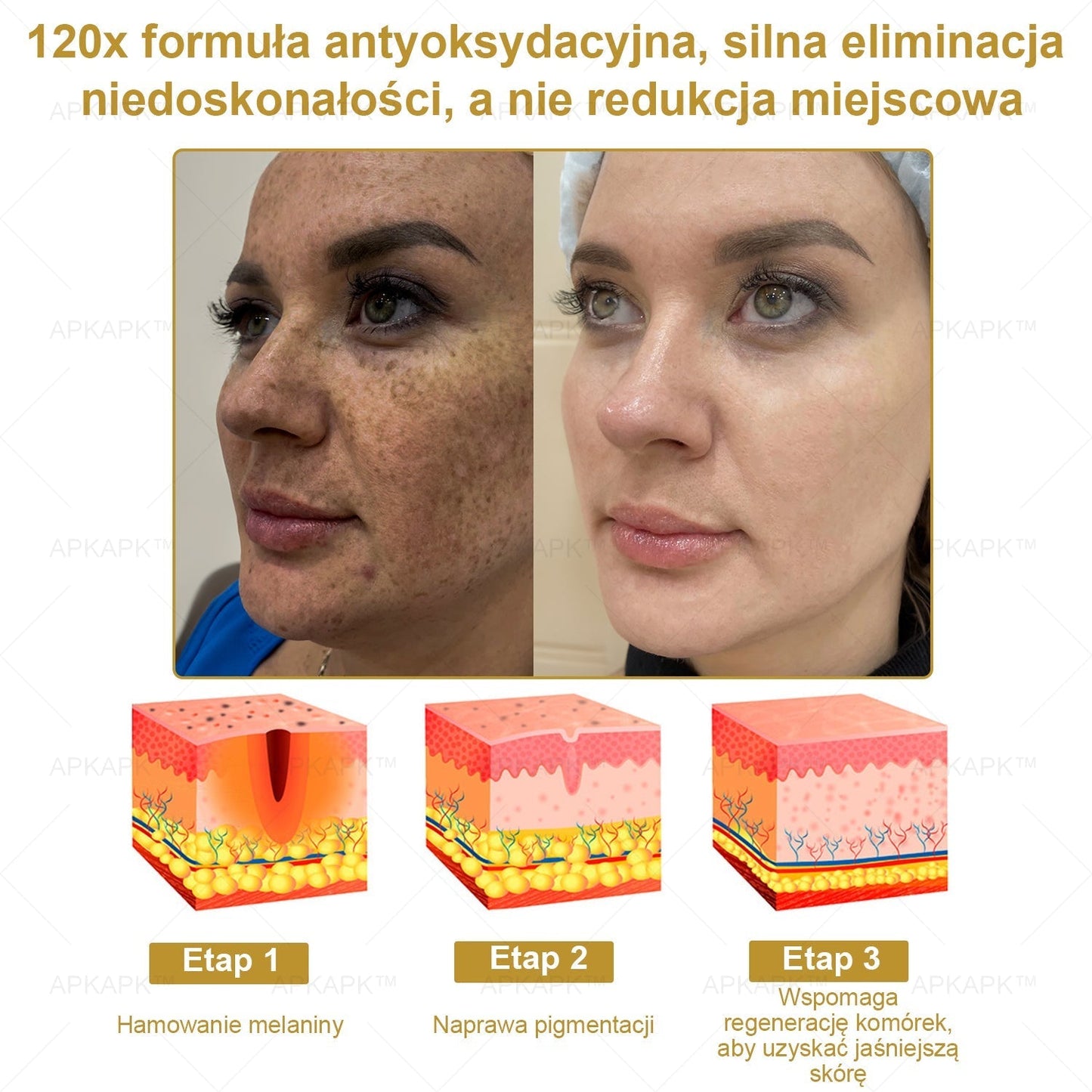 APKAPK™ Skuteczny krem do kompleksowej pielęgnacji skóry, 🧑‍⚕️🧑‍⚕️🧑‍⚕️zatwierdzony przez Polskie Towarzystwo Dermatologiczne (PTD) oraz  – Państwowy Zakład Higieny (PZH).