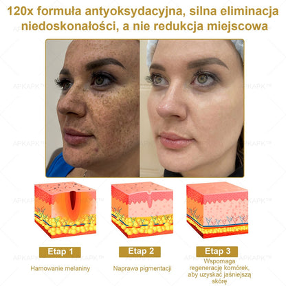 APKAPK™ Skuteczny krem do kompleksowej pielęgnacji skóry, 🧑‍⚕️🧑‍⚕️🧑‍⚕️zatwierdzony przez Polskie Towarzystwo Dermatologiczne (PTD) oraz  – Państwowy Zakład Higieny (PZH).