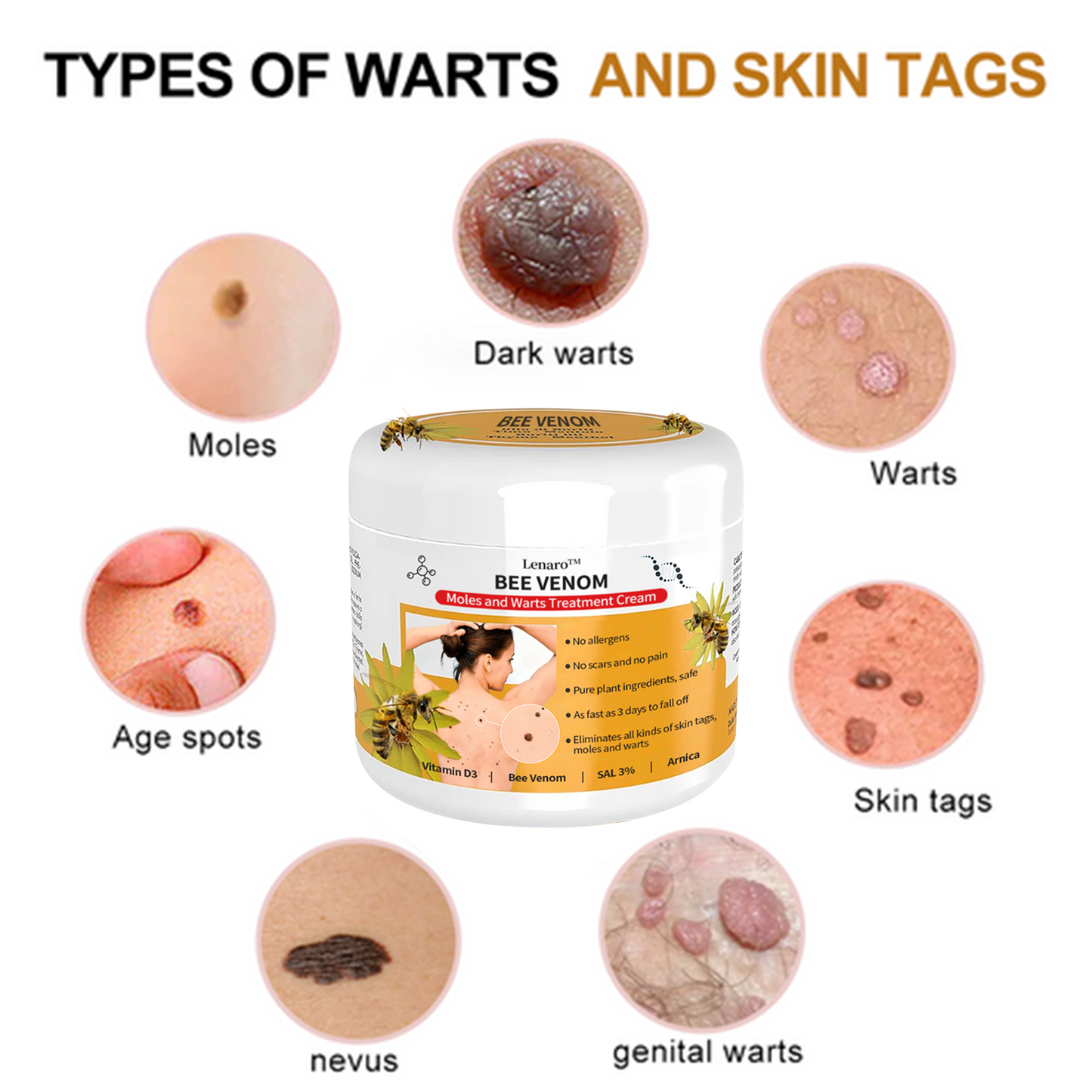 🍀🐝[👑Official Brand Store👑] Cvreoz™ Bee Venom Mole and Wart Treatment Cream(👨‍⚕AAD RECOMMENDS)