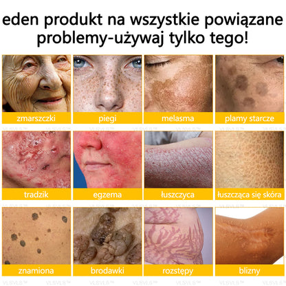 💐🌟💐Wyprodukowano i wysłano z Polski✨ Krem naprawczy do skóry VLSVLS® z jadem pszczelim🔥 Ostatni dzień zniżki 80%
