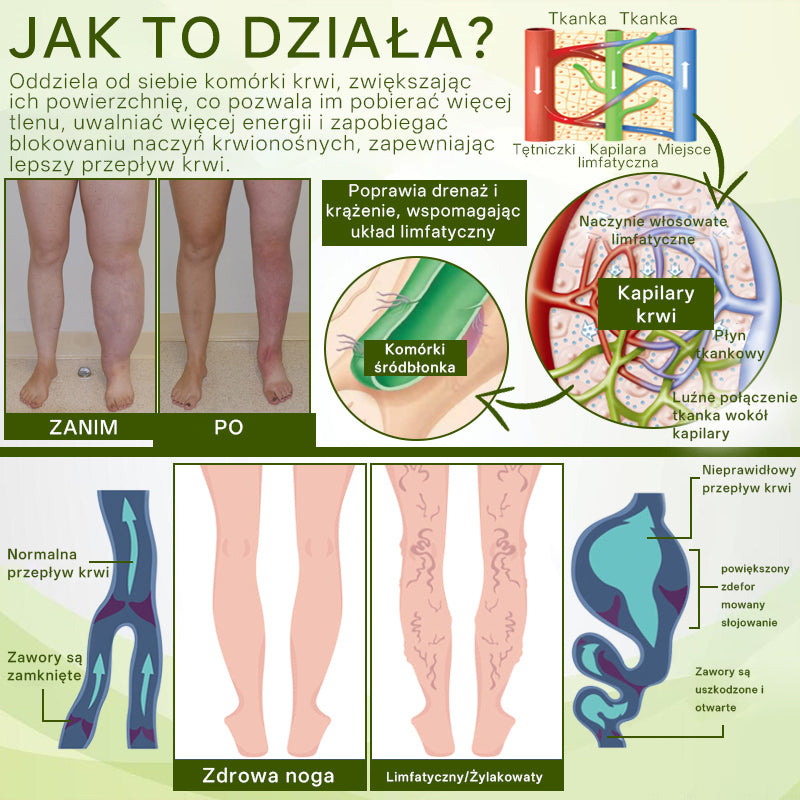[ Efekty już w 7 dni ]👨‍⚕️ Croaie® Krem na Obrzęki i Żylaki (Certyfikat GMP UE • Opracowany na obrzęki, żylaki i słabe krążenie krwi 🦵)