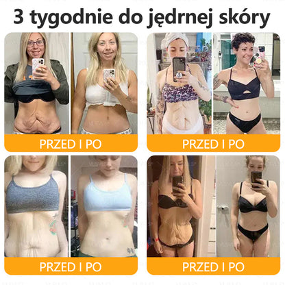 💐🌟💐Wyprodukowano i wysłano z Polski✨ Krem naprawczy do skóry VLSVLS® z jadem pszczelim🔥 Ostatni dzień zniżki 80%