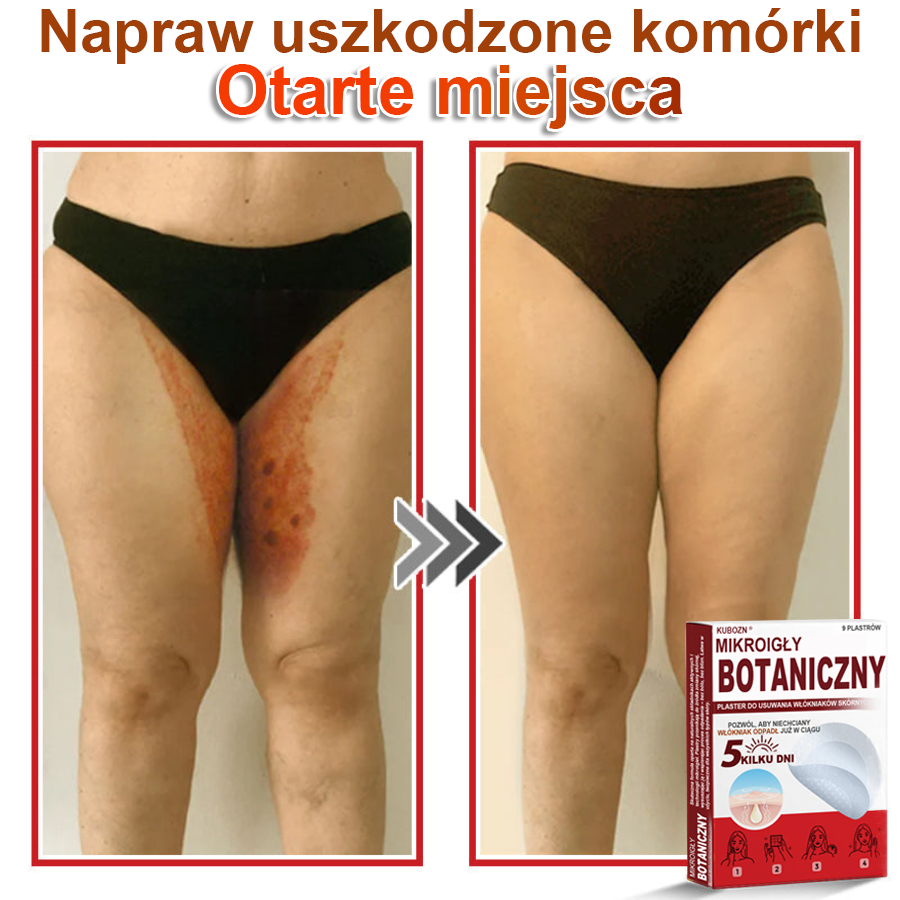 KUBOZN® – 🌿 Mikroigłowy Botaniczny Plaster 🌿 Skuteczne Usuwanie Narośli Skórnych | 💎 Naturalna Formuła