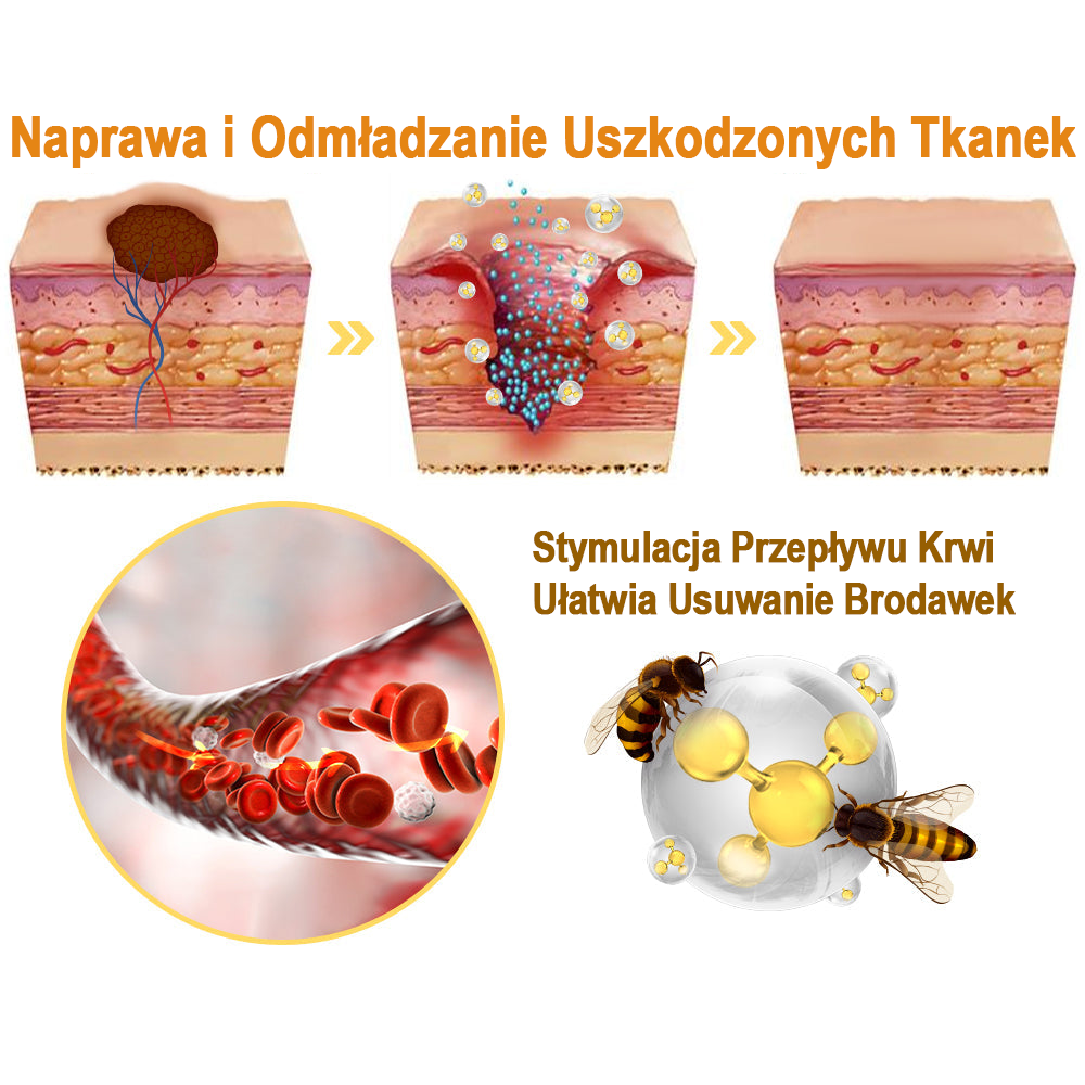🐝flysmus™ Sprej z jadem pszczelim do usuwania brodawek i znamion skórnych 🐝