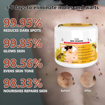 🍀🐝[👑Official Brand Store👑] Cvreoz™ Bee Venom Mole and Wart Treatment Cream(👨‍⚕AAD RECOMMENDS)