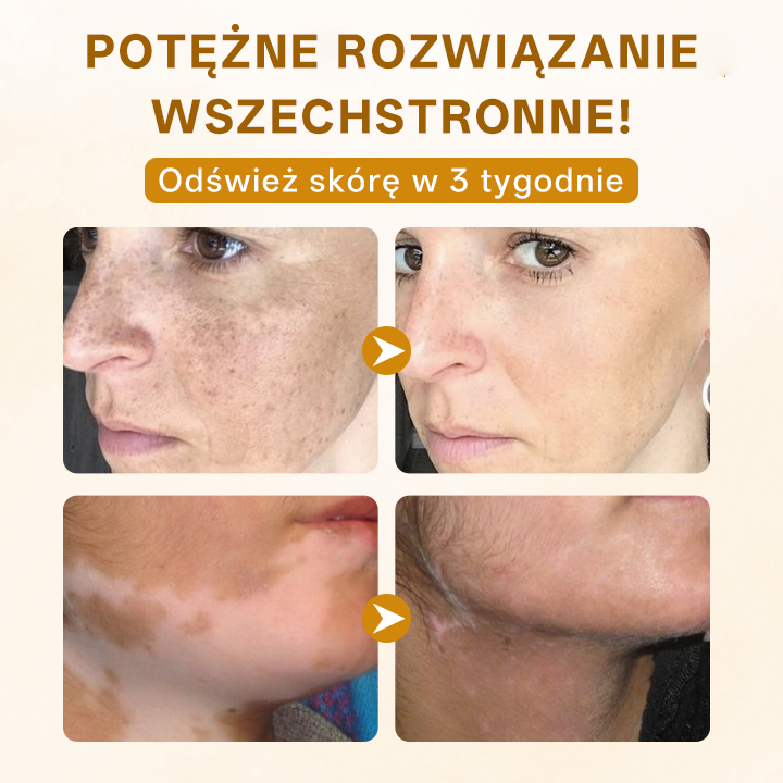 ✨ Timilk® ✨ Ekskluzywny 🌸 Krem Odmładzający z Jadem Pszczelim 🐝 | Luksusowa Pielęgnacja Anti-Aging 💎