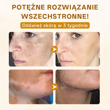 ✨ Timilk® ✨ Ekskluzywny 🌸 Krem Odmładzający z Jadem Pszczelim 🐝 | Luksusowa Pielęgnacja Anti-Aging 💎