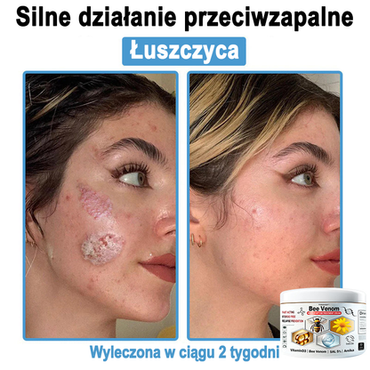 TOD𝐀HOF™🥑 Krem do wielosymptomowej pielęgnacji skóry z jadem pszczelim (Zalecane przez PZH)