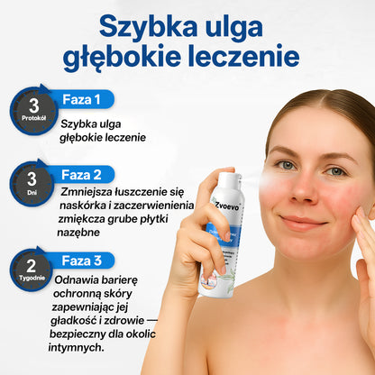 ✅ Oficjalny Sklep: Zvoevo® Magnezowy Ziołowy Spray na Łuszczycę ⚕️ Certyfikowany przez FDA (Łagodzi łuszczycę i egzemę, poprawia infekcje bakteryjne w okolicach intymnych, leczy trądzik i brodawki, łagodzi ból stawów i ból neuropatyczny)