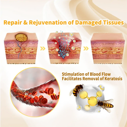 👨‍⚕🐝[👑Official Brand Store👑] Cvreoz™ Bee Venom Lipoma Removal Cream