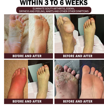 30-Herb Slimming & Detox Foot Bath Medicinal Drops❤️👩‍⚕️