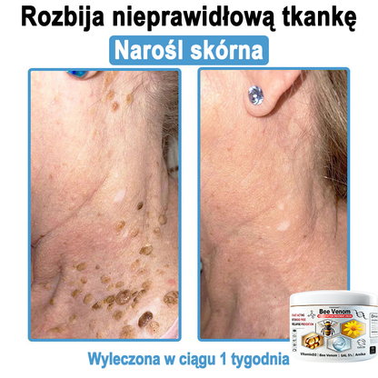 TOD𝐀HOF™🥑 Krem do wielosymptomowej pielęgnacji skóry z jadem pszczelim (Zalecane przez PZH)
