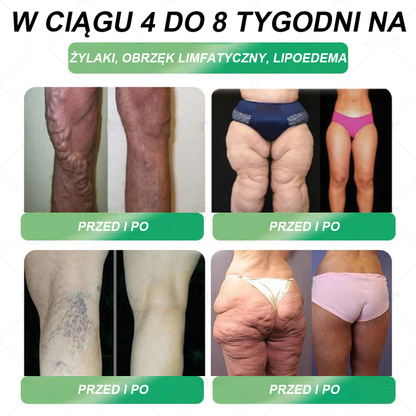 Zalecane przez Centrum Zdrowia w Polsce | Oficjalny sklep 👨‍⚕️HHVB® GLP-1 doustny roztwór na odchudzanie 💥 Otyłość, choroby układu krążenia, cukrzyca, bezdech senny, problemy ze stawami i inne