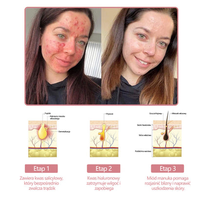Krem kolagenowy w żelu Awzlove™ z koenzymem Q10 jest produktem zatwierdzonym przez Polskie Towarzystwo Dermatologiczne (PTD) i spełnia rygorystyczne normy Narodowego Instytutu Zdrowia Publicznego (PZH).