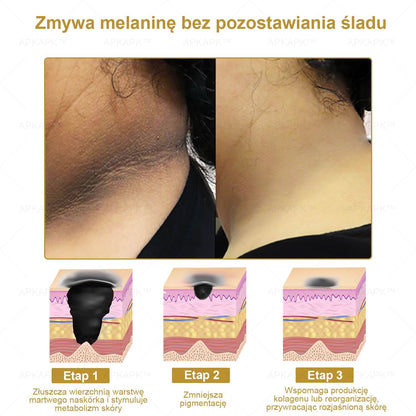APKAPK™ Skuteczny krem do kompleksowej pielęgnacji skóry, 🧑‍⚕️🧑‍⚕️🧑‍⚕️zatwierdzony przez Polskie Towarzystwo Dermatologiczne (PTD) oraz  – Państwowy Zakład Higieny (PZH).