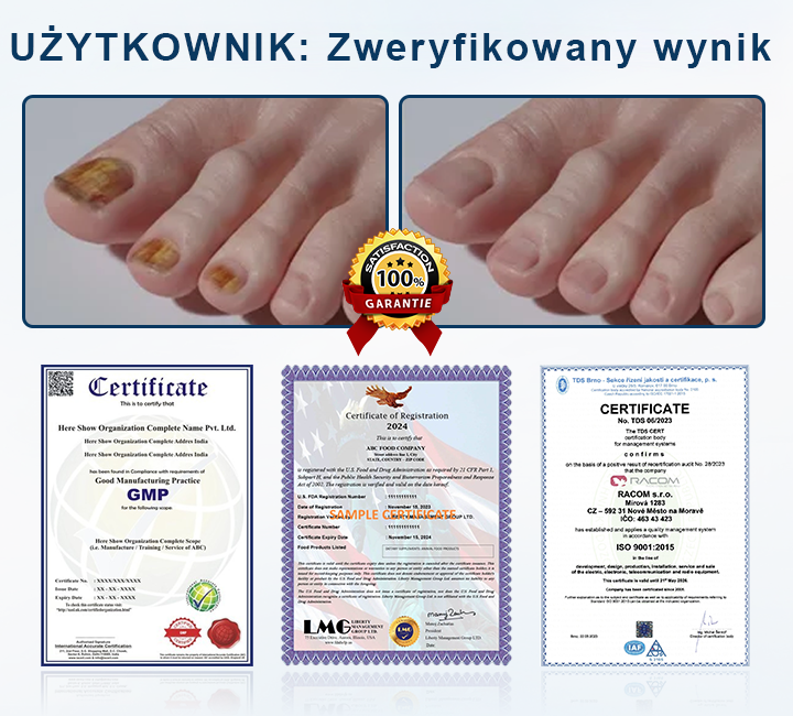 ✨ Timilk® ✨ – 🌿 Ziołowy Spray Przeciwgrzybiczy do Paznokci i Skóry 🦶