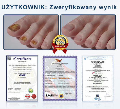 ✨ Timilk® ✨ – 🌿 Ziołowy Spray Przeciwgrzybiczy do Paznokci i Skóry 🦶
