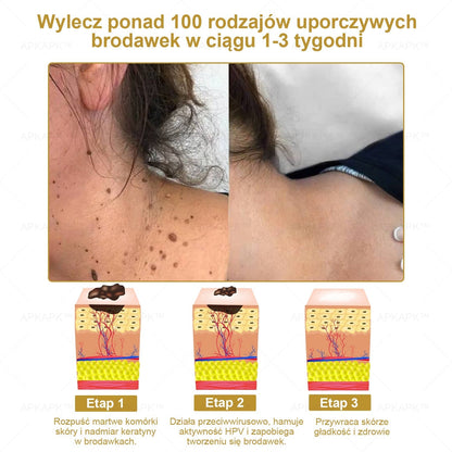 APKAPK™ Skuteczny krem do kompleksowej pielęgnacji skóry, 🧑‍⚕️🧑‍⚕️🧑‍⚕️zatwierdzony przez Polskie Towarzystwo Dermatologiczne (PTD) oraz  – Państwowy Zakład Higieny (PZH).