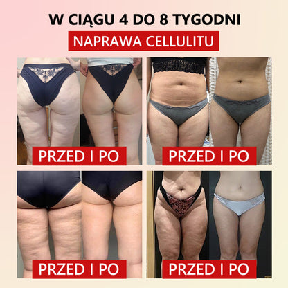 Flouris™ Mikro-wibracyjny Pas Wzmacniający Zioło Piołun do Kształtowania Ciała❤️ (Zalecane przez chirurgów plastycznych)