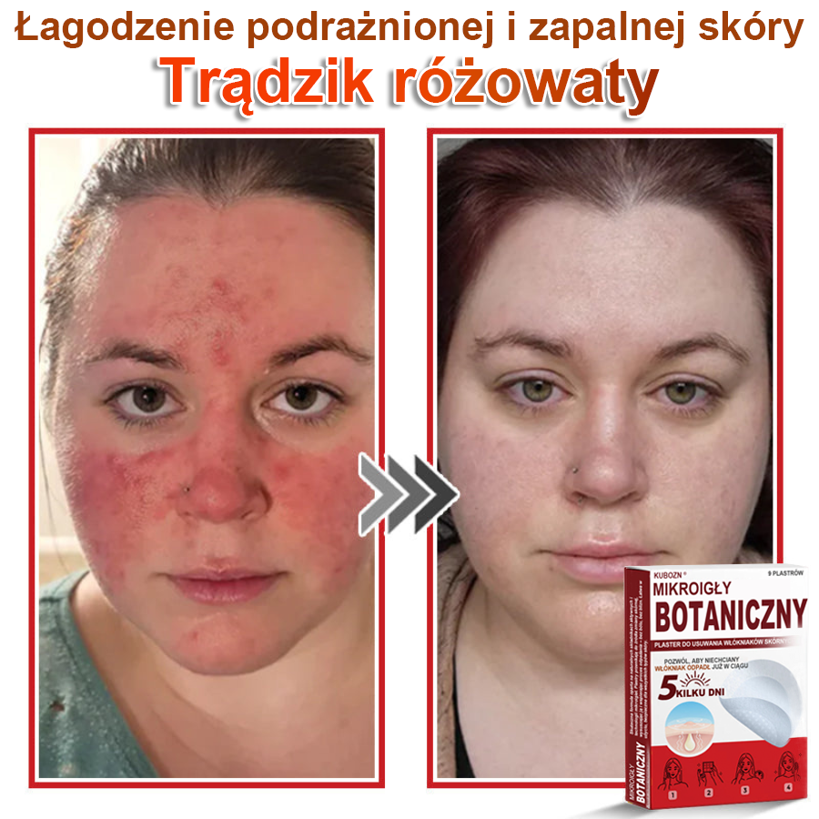 KUBOZN® – 🌿 Mikroigłowy Botaniczny Plaster 🌿 Skuteczne Usuwanie Narośli Skórnych | 💎 Naturalna Formuła