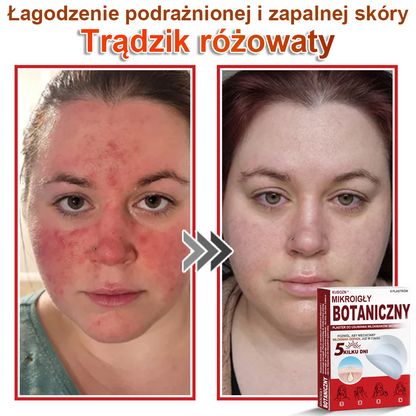 KUBOZN® – 🌿 Mikroigłowy Botaniczny Plaster 🌿 Skuteczne Usuwanie Narośli Skórnych | 💎 Naturalna Formuła