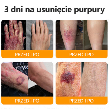 💐🌟💐Wyprodukowano i wysłano z Polski✨ Krem naprawczy do skóry VLSVLS® z jadem pszczelim🔥 Ostatni dzień zniżki 80%