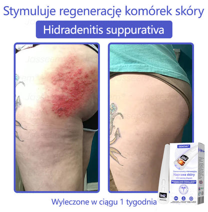 SIE𝖭𝖮𝖵𝖠™ Zaawansowany nieinwazyjny laser CO₂ do naprawy skóry 🎉 (Delikatnie usuwa brodawki, znamiona, plamy starcze i narośla skórne – bez bólu, bez zamieszania!)