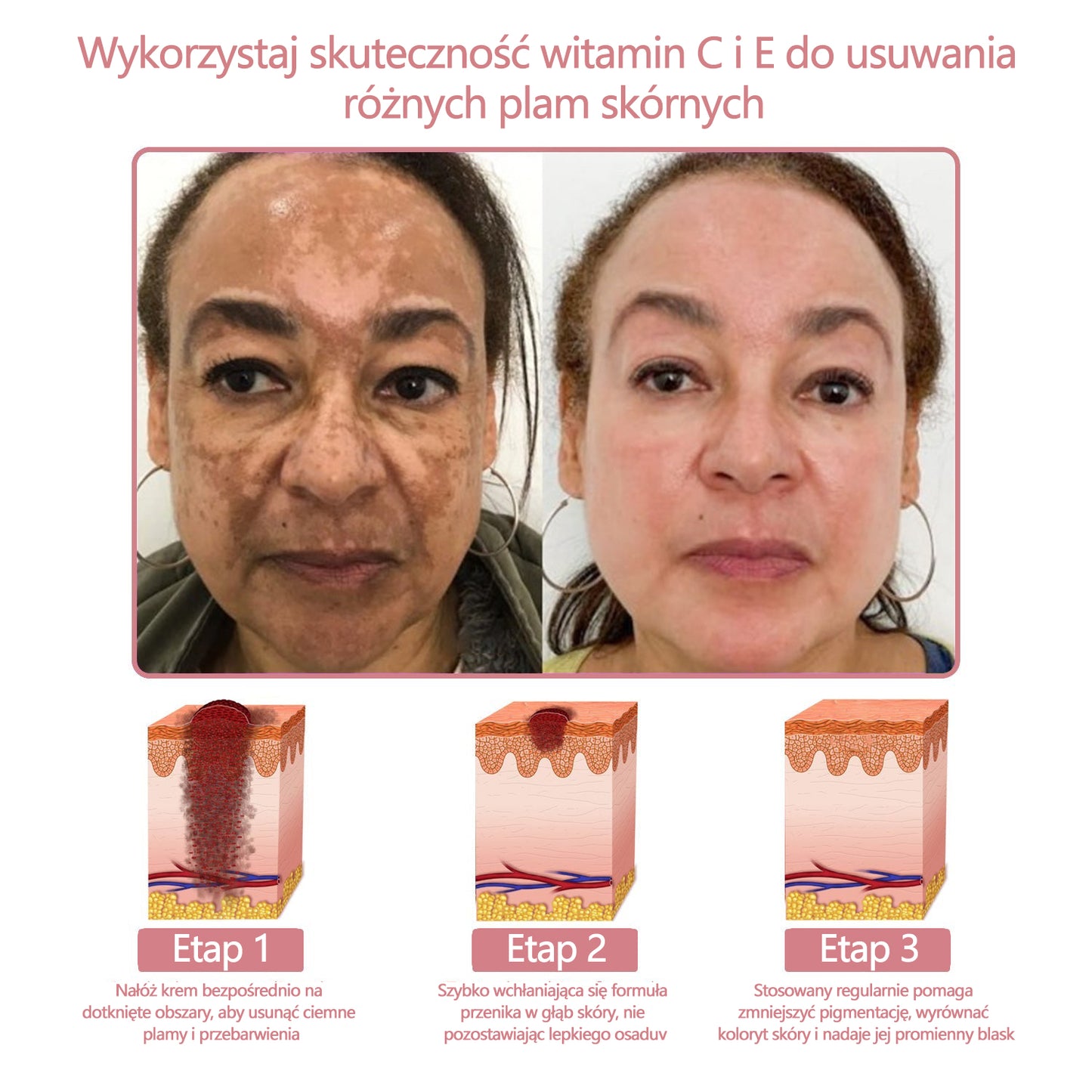 Krem kolagenowy w żelu Awzlove™ z koenzymem Q10 jest produktem zatwierdzonym przez Polskie Towarzystwo Dermatologiczne (PTD) i spełnia rygorystyczne normy Narodowego Instytutu Zdrowia Publicznego (PZH).