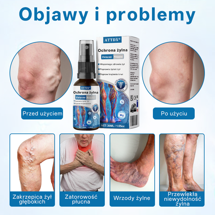 🌿🌿 🌿ATTDX® – Ziołowy Spray na Żylaki z Potwierdzoną Skutecznością w 7 Dni!