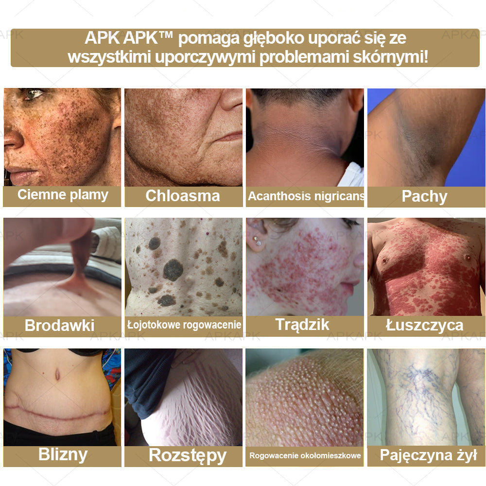 APKAPK™ Skuteczny krem do kompleksowej pielęgnacji skóry, 🧑‍⚕️🧑‍⚕️🧑‍⚕️zatwierdzony przez Polskie Towarzystwo Dermatologiczne (PTD) oraz  – Państwowy Zakład Higieny (PZH).