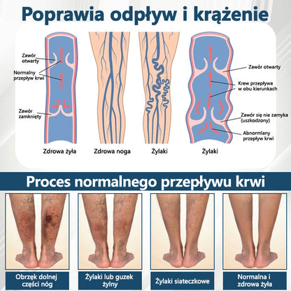 Detoksykujący krem ziołowy z czarnym kminkiem Cvreoz®🩹🩹