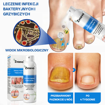 ✅ Oficjalny Sklep: Zvoevo® Magnezowy Ziołowy Spray na Łuszczycę ⚕️ Certyfikowany przez FDA (Łagodzi łuszczycę i egzemę, poprawia infekcje bakteryjne w okolicach intymnych, leczy trądzik i brodawki, łagodzi ból stawów i ból neuropatyczny)