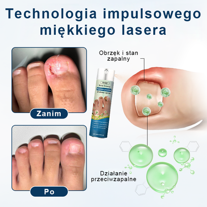 ✨ Timilk® ✨ – 🌿 Ziołowy Spray Przeciwgrzybiczy do Paznokci i Skóry 🦶