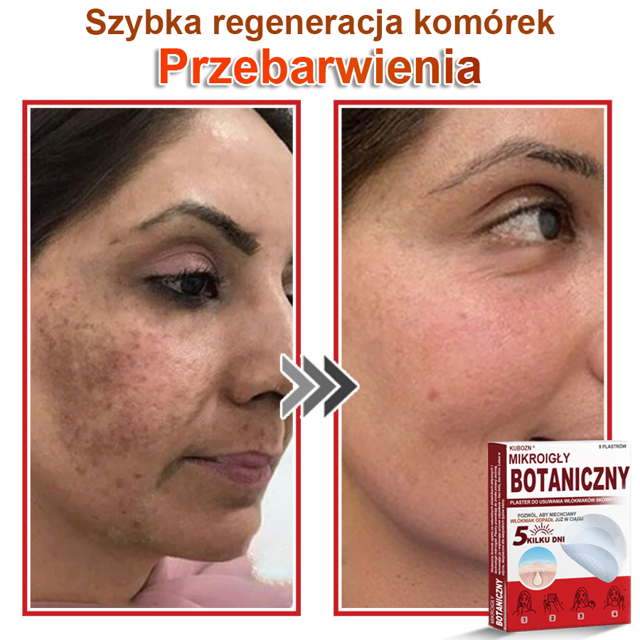 KUBOZN® – 🌿 Mikroigłowy Botaniczny Plaster 🌿 Skuteczne Usuwanie Narośli Skórnych | 💎 Naturalna Formuła